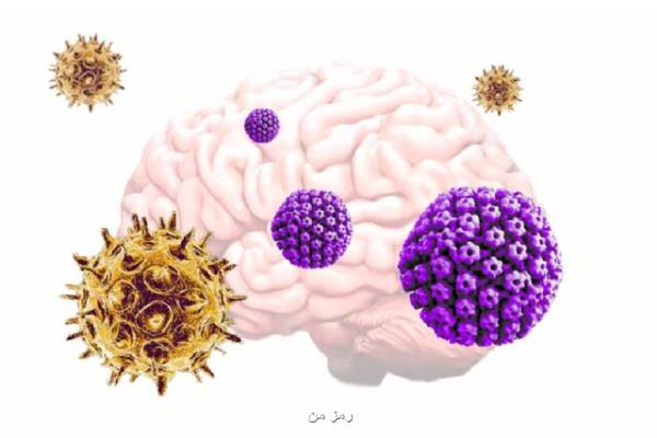 ارتباط آلزایمر با آبله مرغان و تبخال!