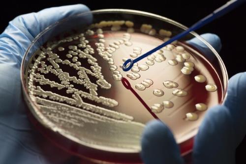 درخشش آنتی بیوتیک های مبتنی بر طلا در درمان بیماریهای باکتریایی