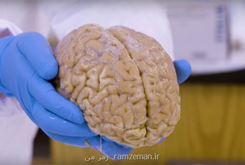 وضعیت اهدای مغز در كشورهای دیگر چگونه است؟