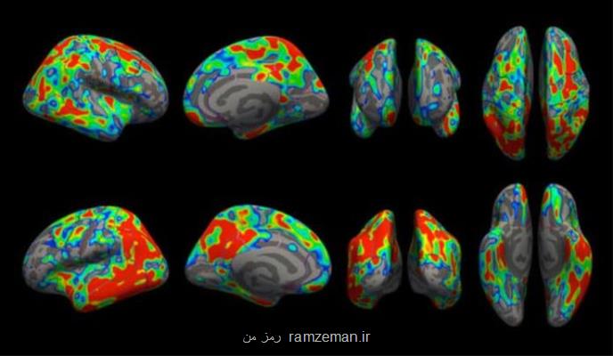 مشاهده میزان از بین رفتن سیناپس های مغز در مراحل اولیه آلزایمر